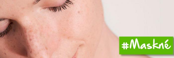 3 SECRETOS PARA MANTENER LOS GRANITOS POR LA MASCARILLA A RAYA