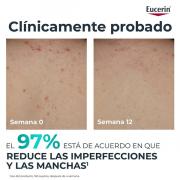 Miniatura - EUCERIN DERMOPURE CLINICAL CREMA CORPORAL CORRECTORA (200ML)