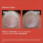 Miniatura - ISDIN SI-NAILS FORTALECEDOR DE UÑAS (2,5ML) 