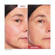 Miniatura - ERBORIAN SKIN THERAPY ACEITE NOCHE (30ML)