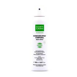 ACNIOVER CORPORAL (150ML)