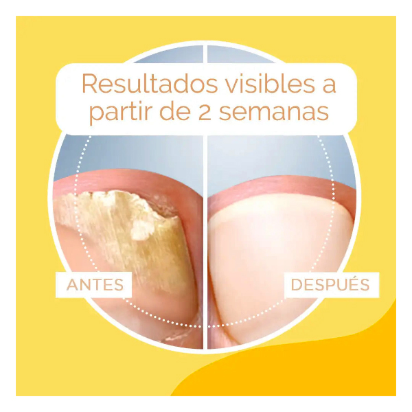 SCHOLL ANTI-HONGOS TRATAMIENTO UÑAS 2 EN 1