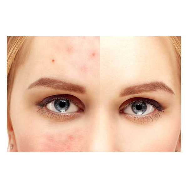 KENVUE NEOSTRATA CLARIFY HIDRATANTE ANTIARRUGAS SPF40 (50ml) 