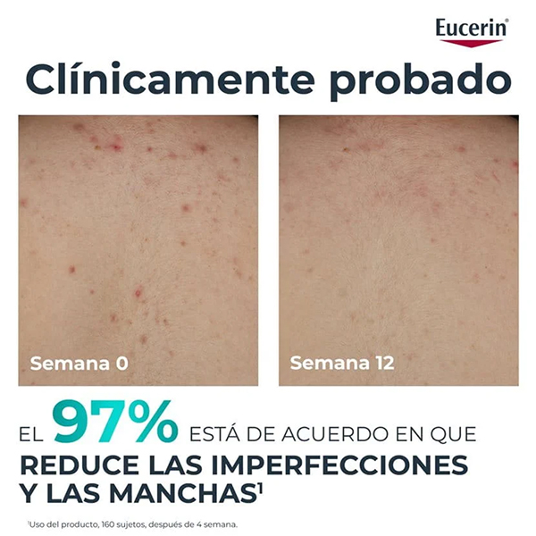 EUCERIN DERMOPURE CLINICAL CREMA CORPORAL CORRECTORA (200ML)