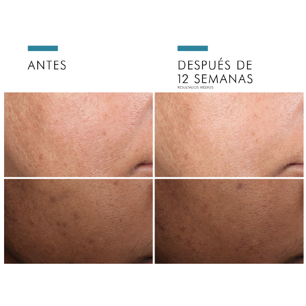 SKINCEUTICALS DISCOLORATION DEFENSE SERUM ANTIMANCHAS (30ML)	