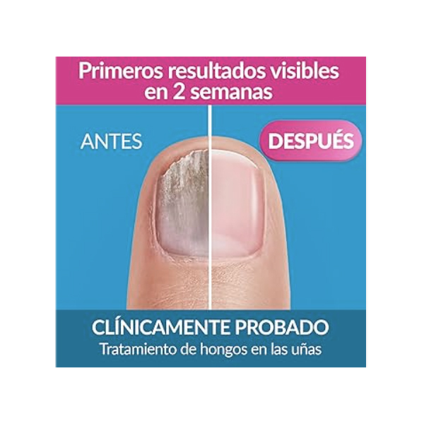 EXCILOR EXCILOR ESMALTE  CON PINCEL MICOSIS UÑAS (30ml)