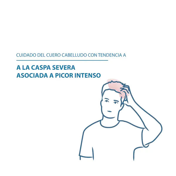 DUCRAY KELUAL DS CHAMPÚ ANTICASPA (100ML)