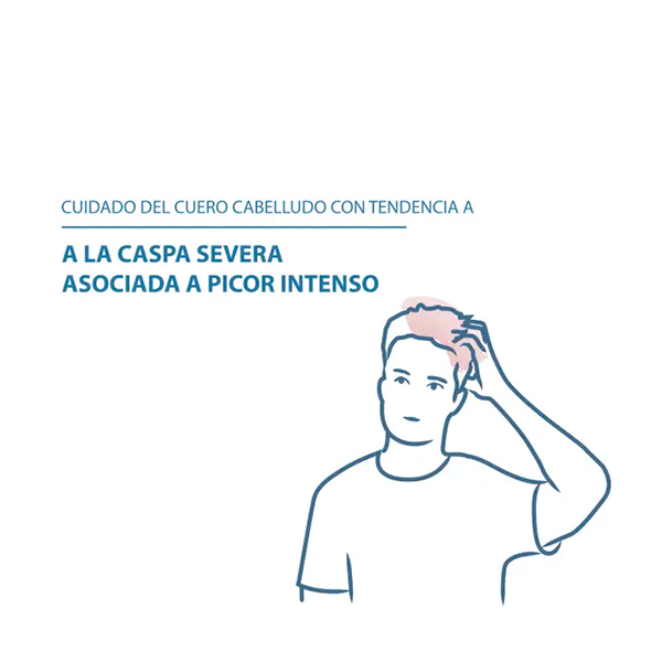 DUCRAY KELUAL DS CHAMPÚ ANTICASPA (100ML)