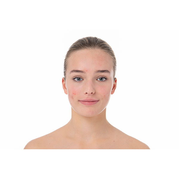 BIODERMA PHOTODERM AKN MAT FLUIDO SPF30 PIEL ACNÉ (40ml)