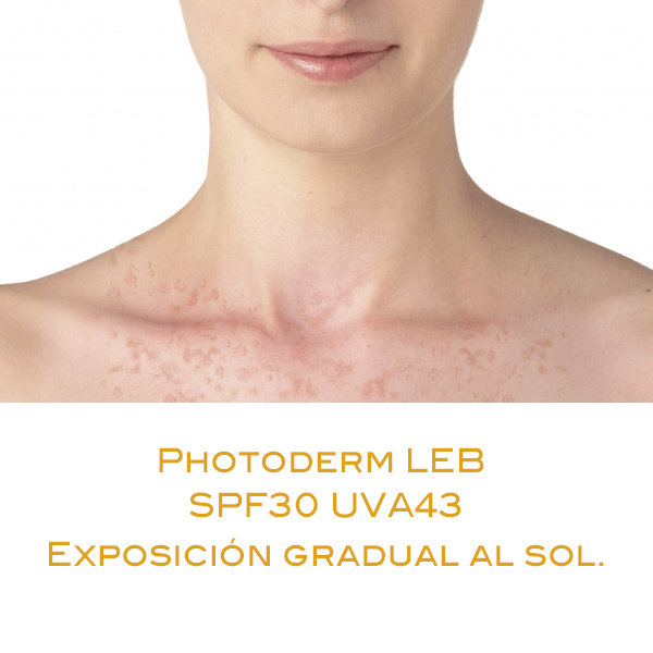 BIODERMA PHOTODERM LEB SPF30 ALERGIA SOLAR (100ml)