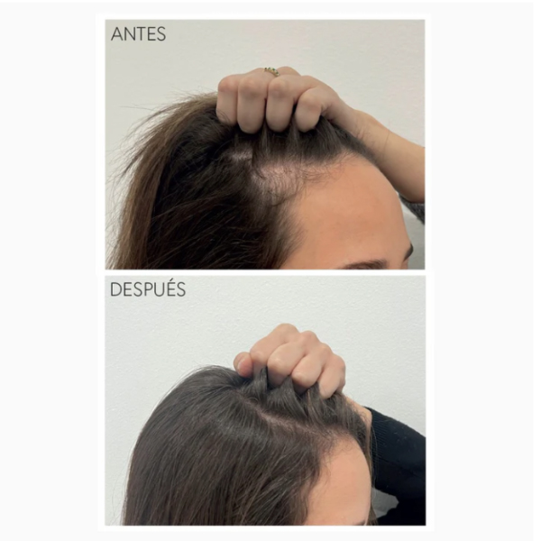 MONCHO MORENO RAPUNHAIR SERUM DE CRECIMIENTO (70ML)