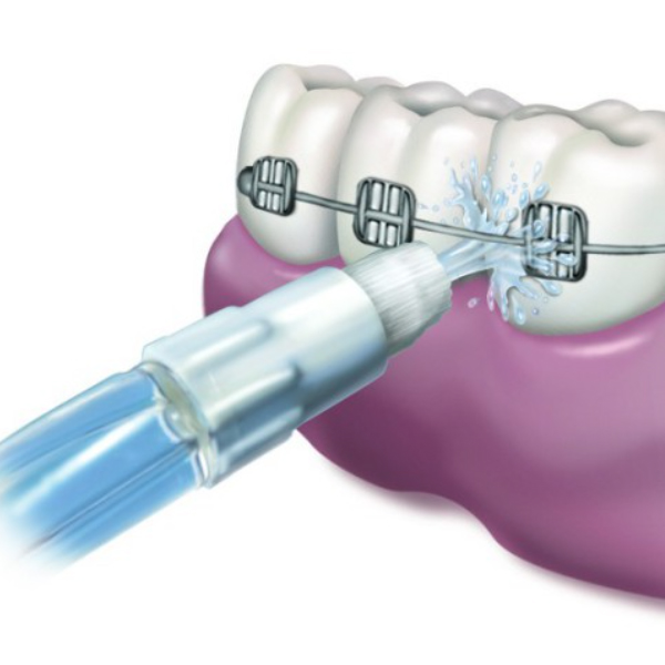 WATERPIK Recambio WP100 y WP360 Boquillas ortodónticas (2 UNIDADES)