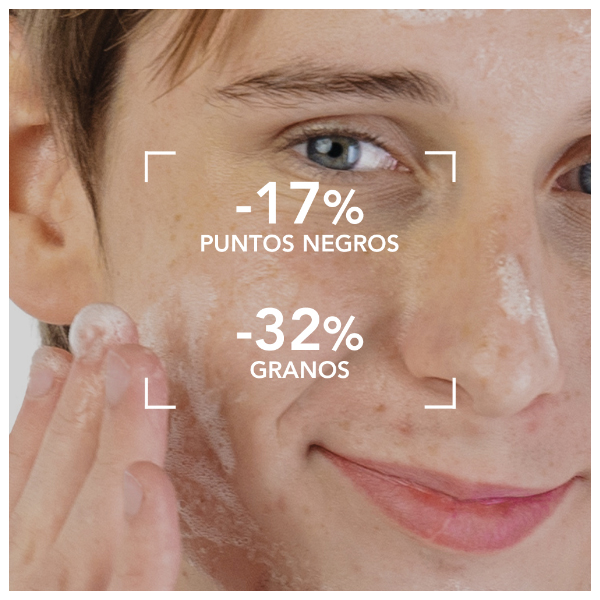 BIODERMA SEBIUM GEL MOUSSANT ACTIF TUBO (200ML)	