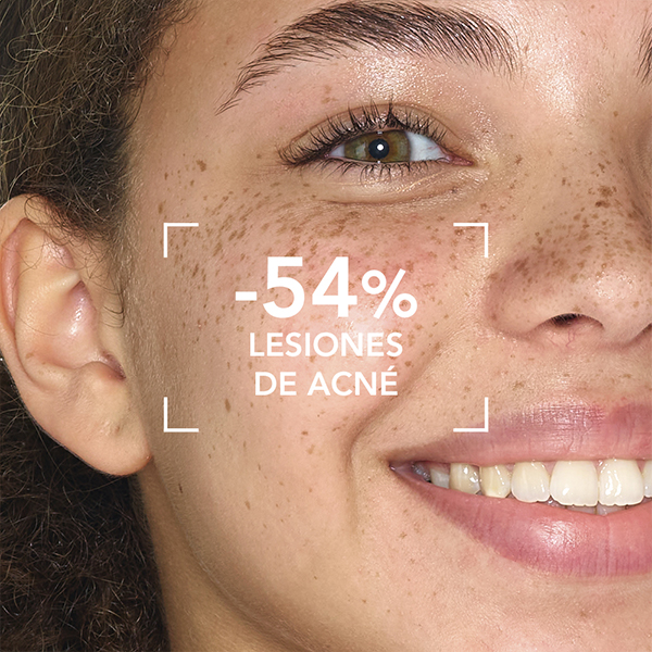 BIODERMA Sébium Sensitive (30ml)