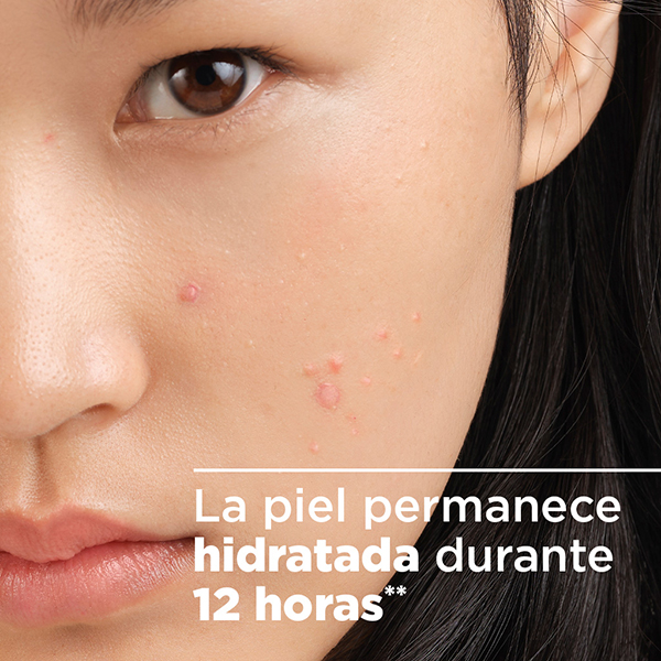 BIODERMA SEBIUM SENSITIVE REHIDRATANTE PIEL ACNÉ (30ML)