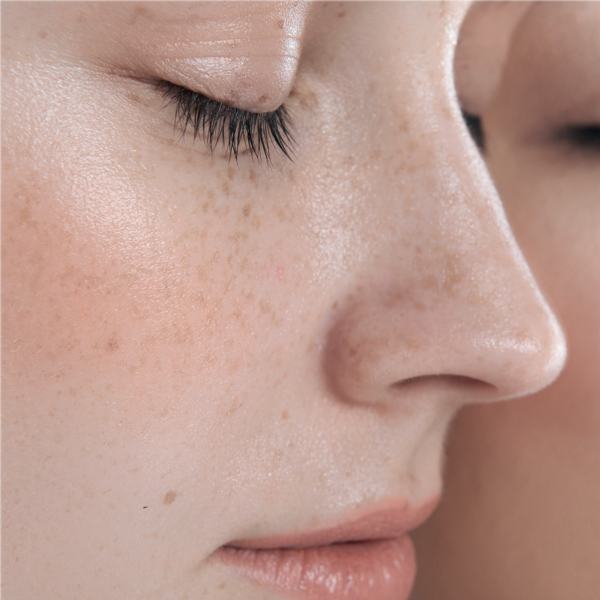 A-DERMA SOLAR EPITHELIALE AH ULTRA REPAIR CREMA SPF50 (40ML)