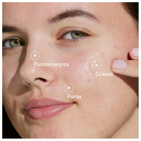 CAUDALIE STARTER KIT RUTINA VINOPURE