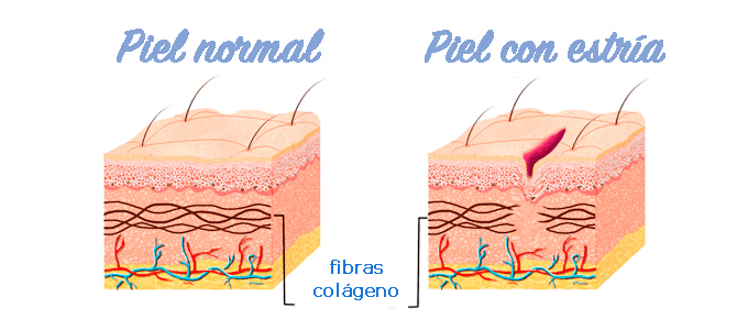 post-cosmetica-apta-embarazo