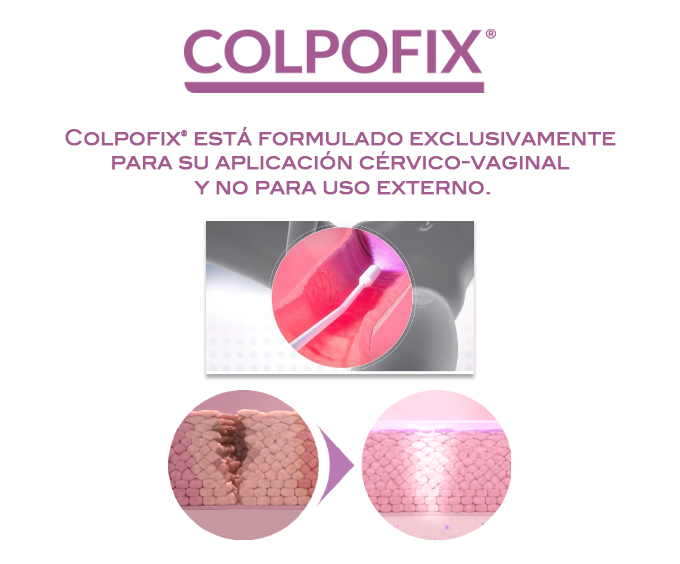 colpofix y virus papiloma