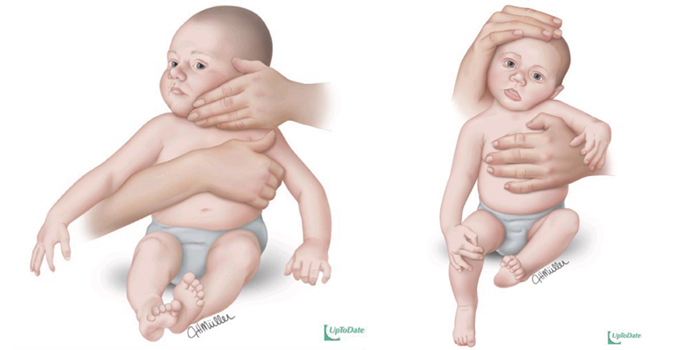 ejercicios bebe infocefalia cojin mimos