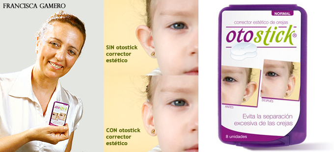 Otostick Bebés - Corrector de orejas para bebés (Adhesivos)