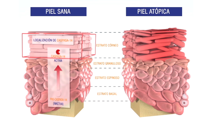 piel atopica